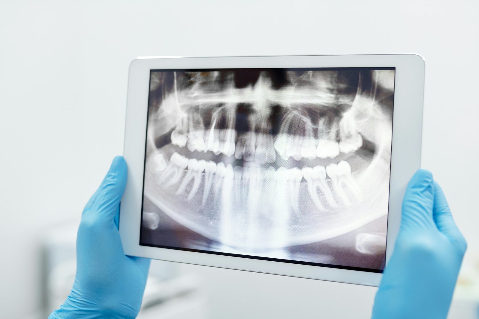 A deep learning vision–language model for diagnosing pediatric dental diseases