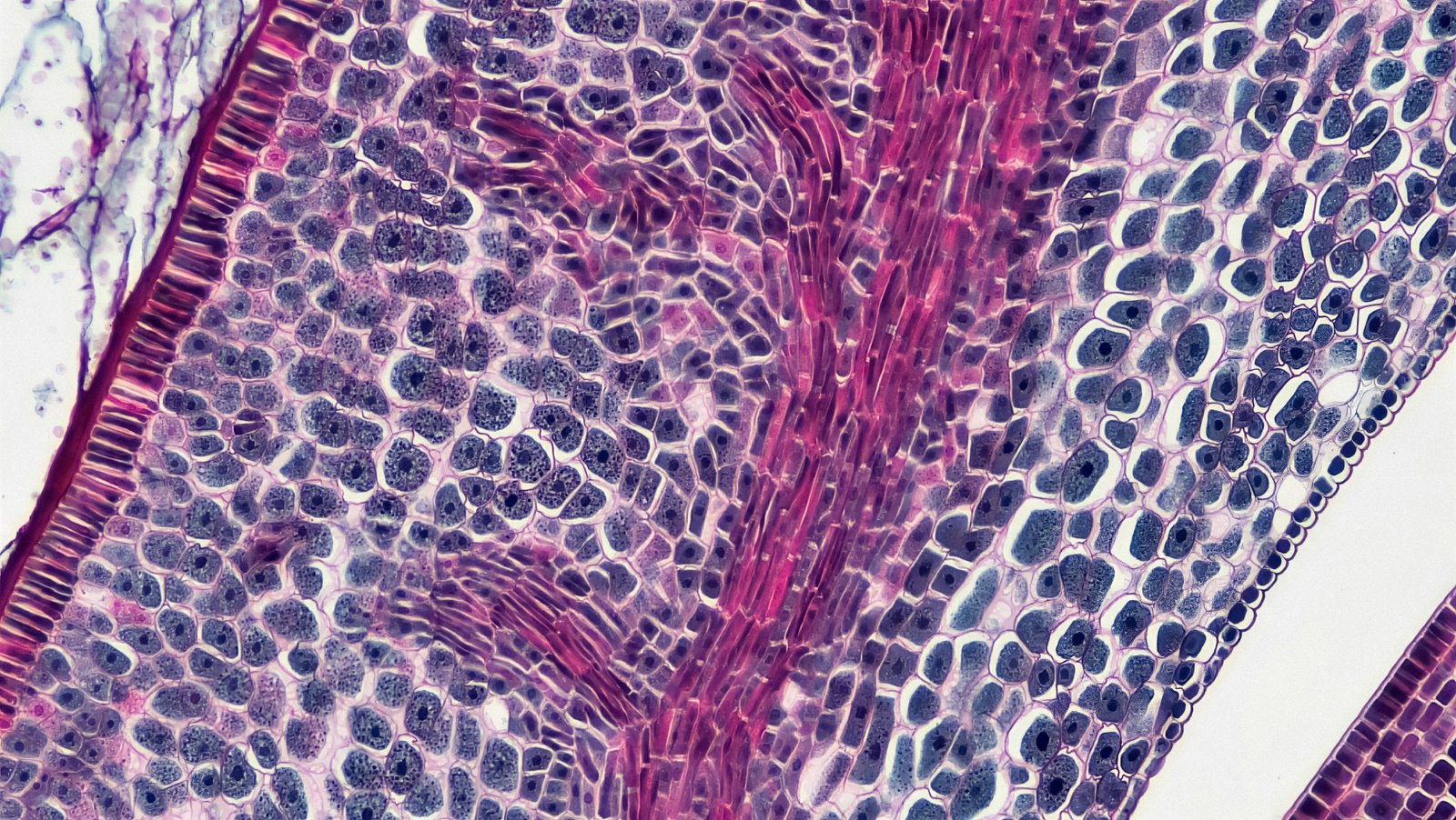 Spatial transcriptomics maps host–gut microbiome biogeography at high resolution