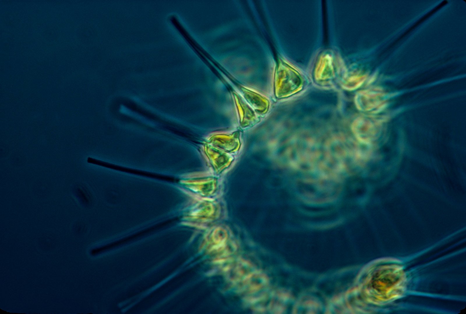 Microscopic image of yellowish-green flagellated microorganisms with pear-shaped bodies and whip-like tails against a dark teal background.