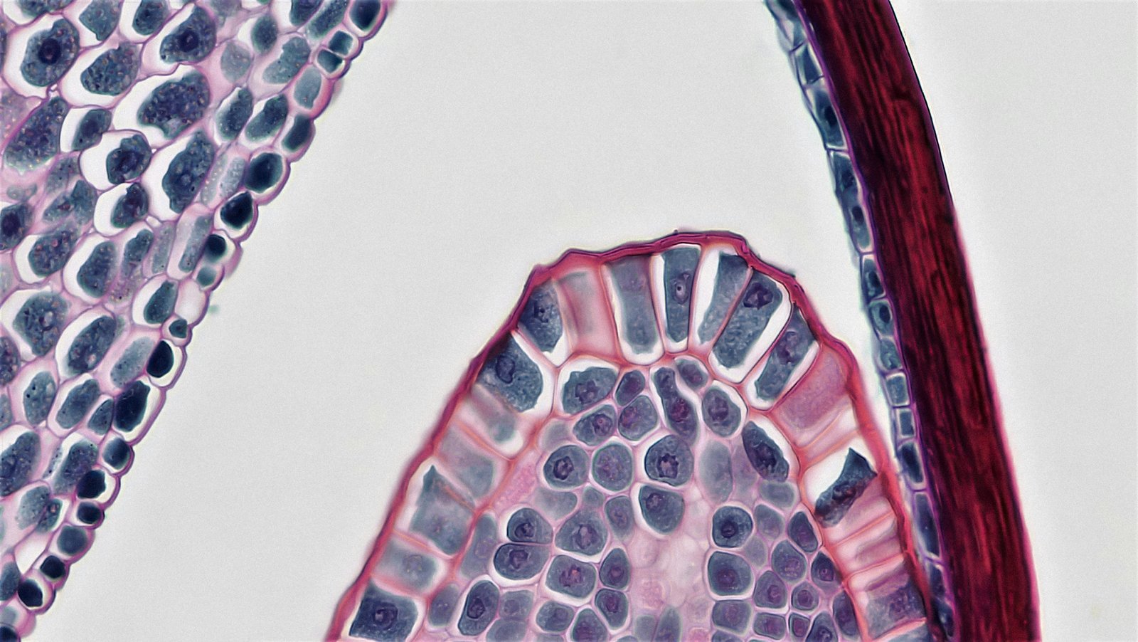In vitro characterization of osteoblasts from craniofacial fibrous dysplasia of bone and their impact on bone homeostasis