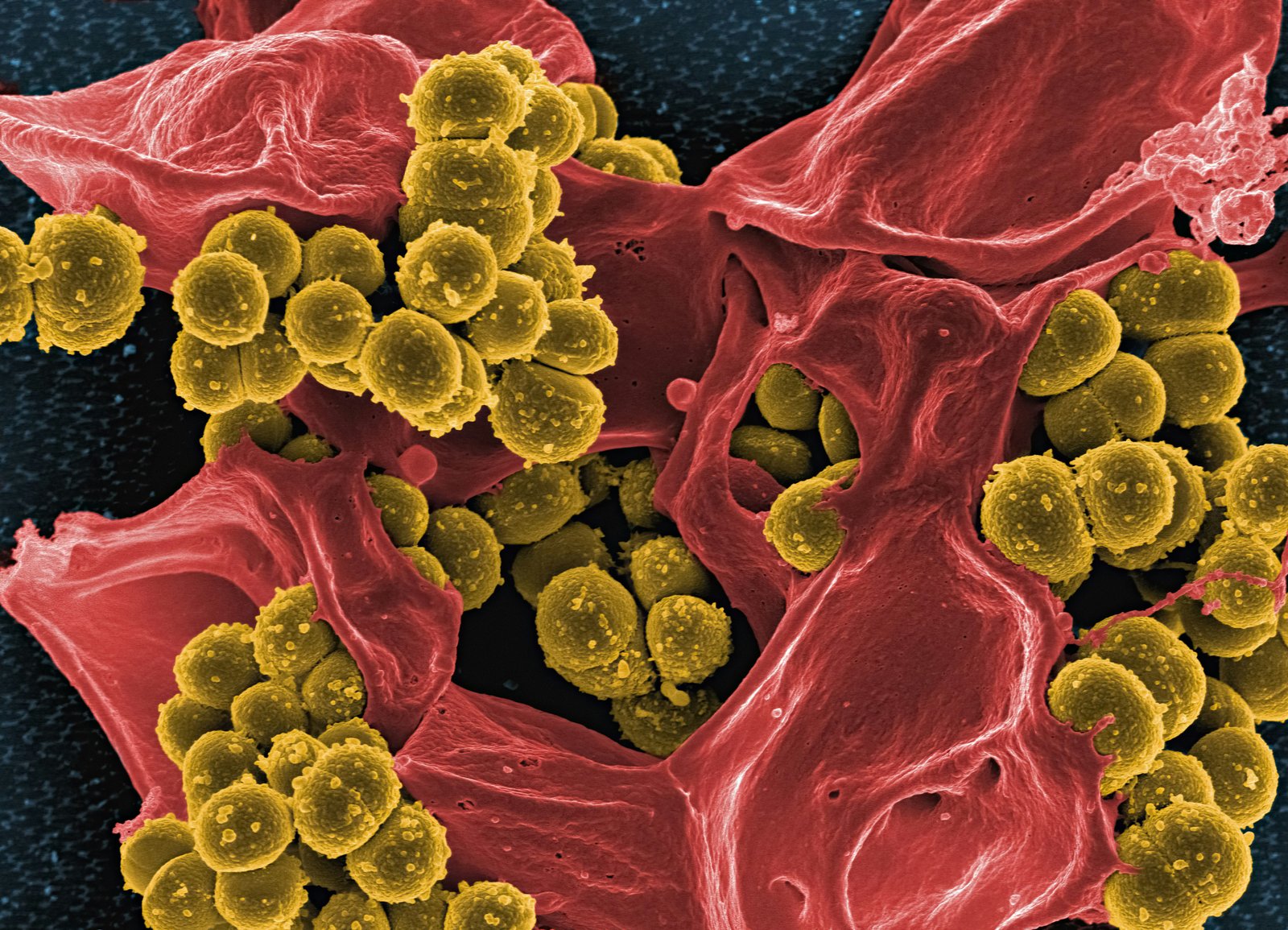 A scanning electron microscope image showing yellow-colored spherical bacterial cells clustered together on a red-textured surface, depicting bacterial colonies in close-up detail.