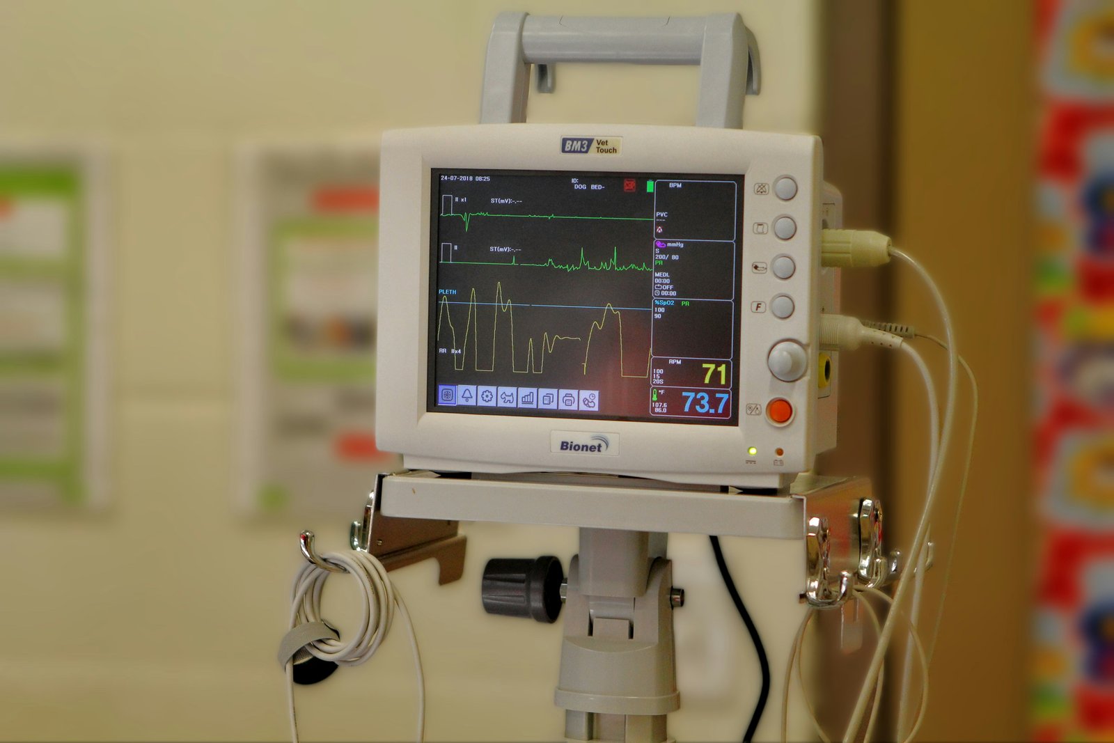 Optical coherence tomography-derived coronary vessel wall abnormalities in adults long after Kawasaki disease