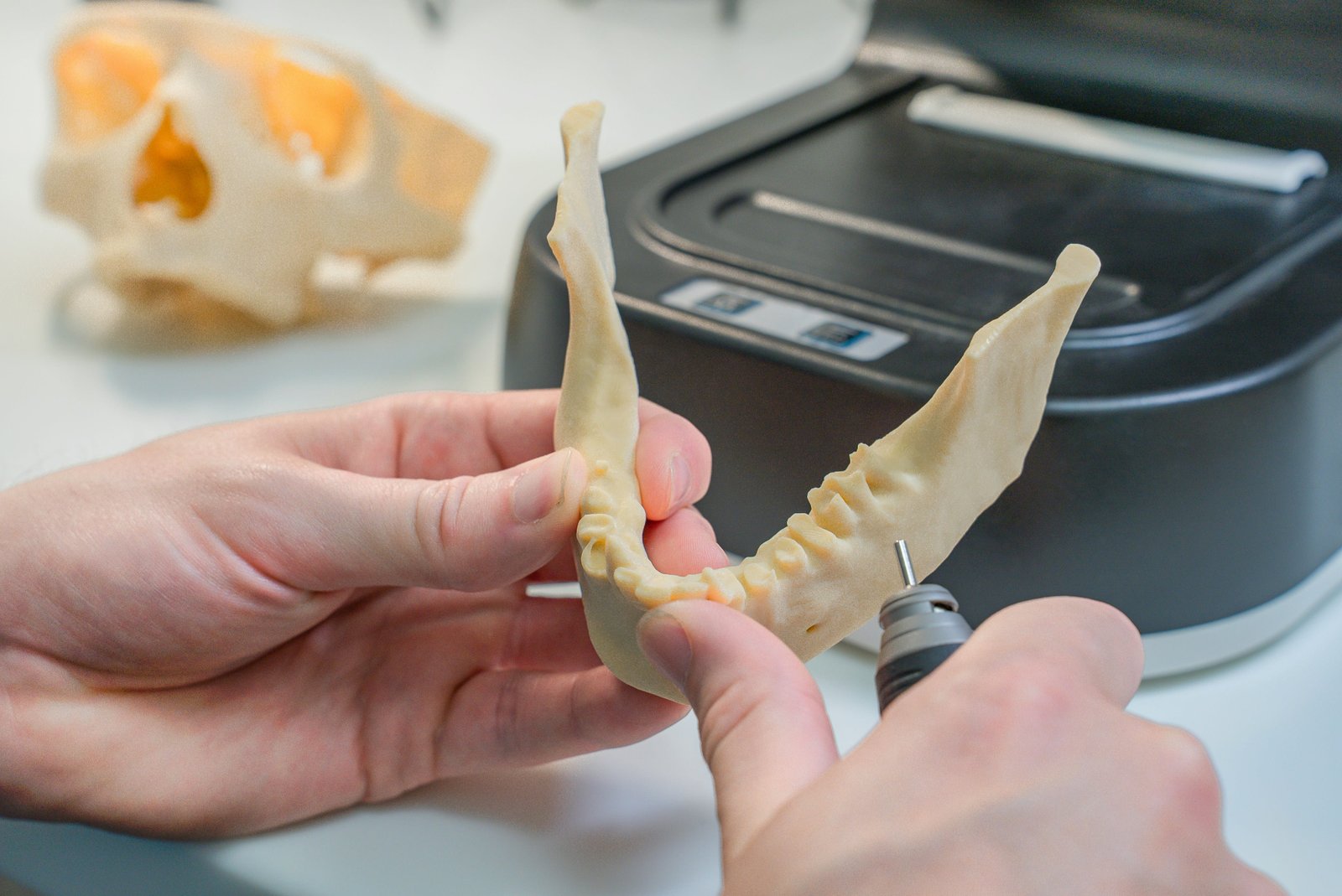 Assessing the impact of bone type on the accuracy of methylation-based forensic age estimation