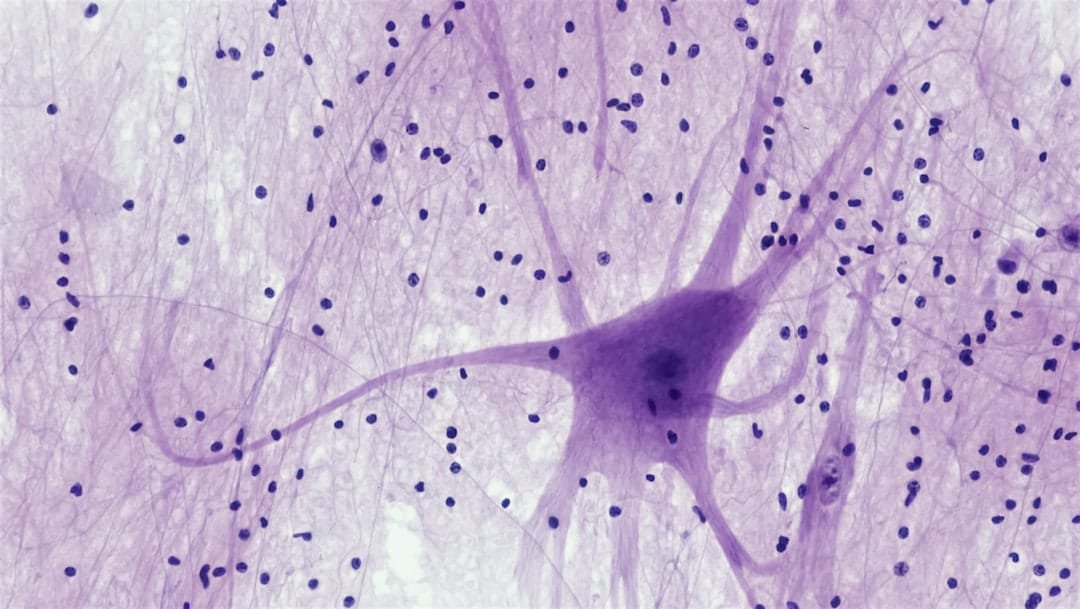 Brief electrical stimulation induced ketamine-like plasticity in human neurons