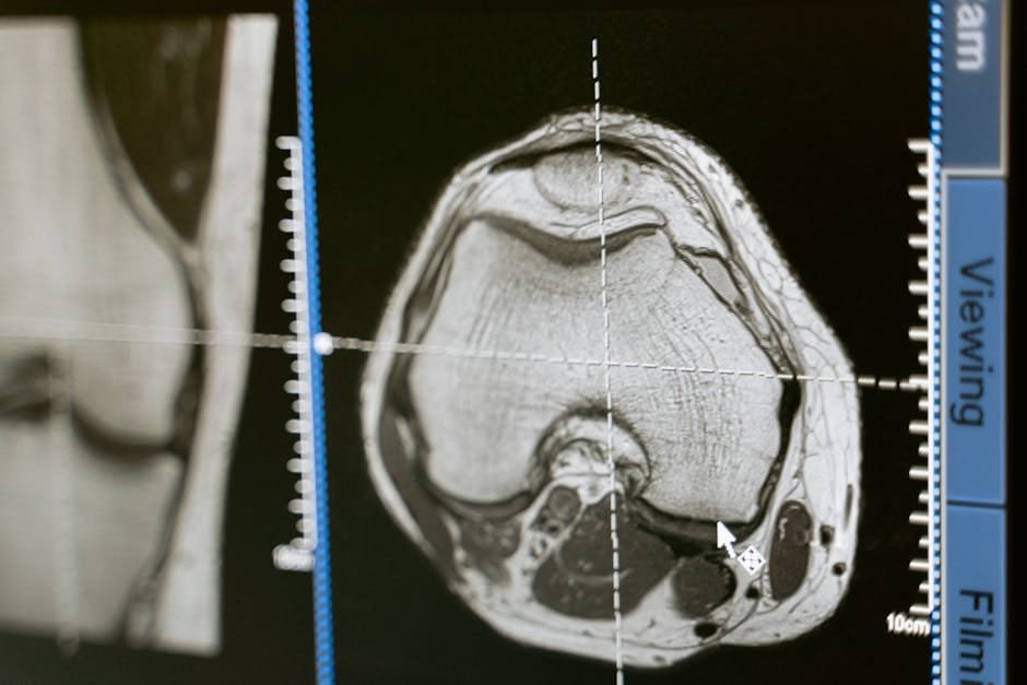 PET/CT lesion profiles matched tuberculosis treatment outcomes in marmosets