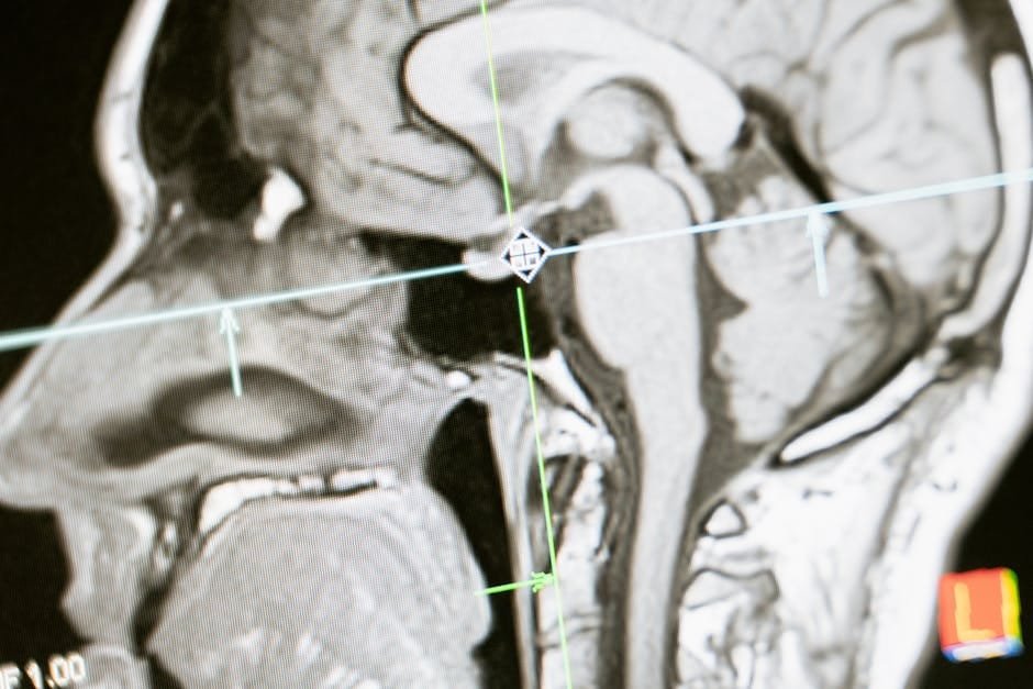 Mediterranean diet linked to better white matter integrity