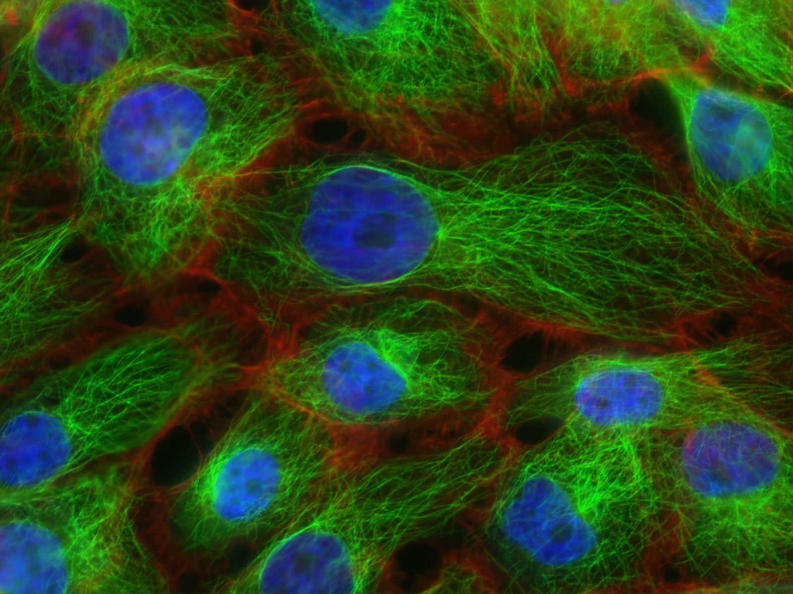 Synthesis and Anticancer Evaluation of PCNA Inhibitor AOH1996 Analogs in Cancer Cell Cultures